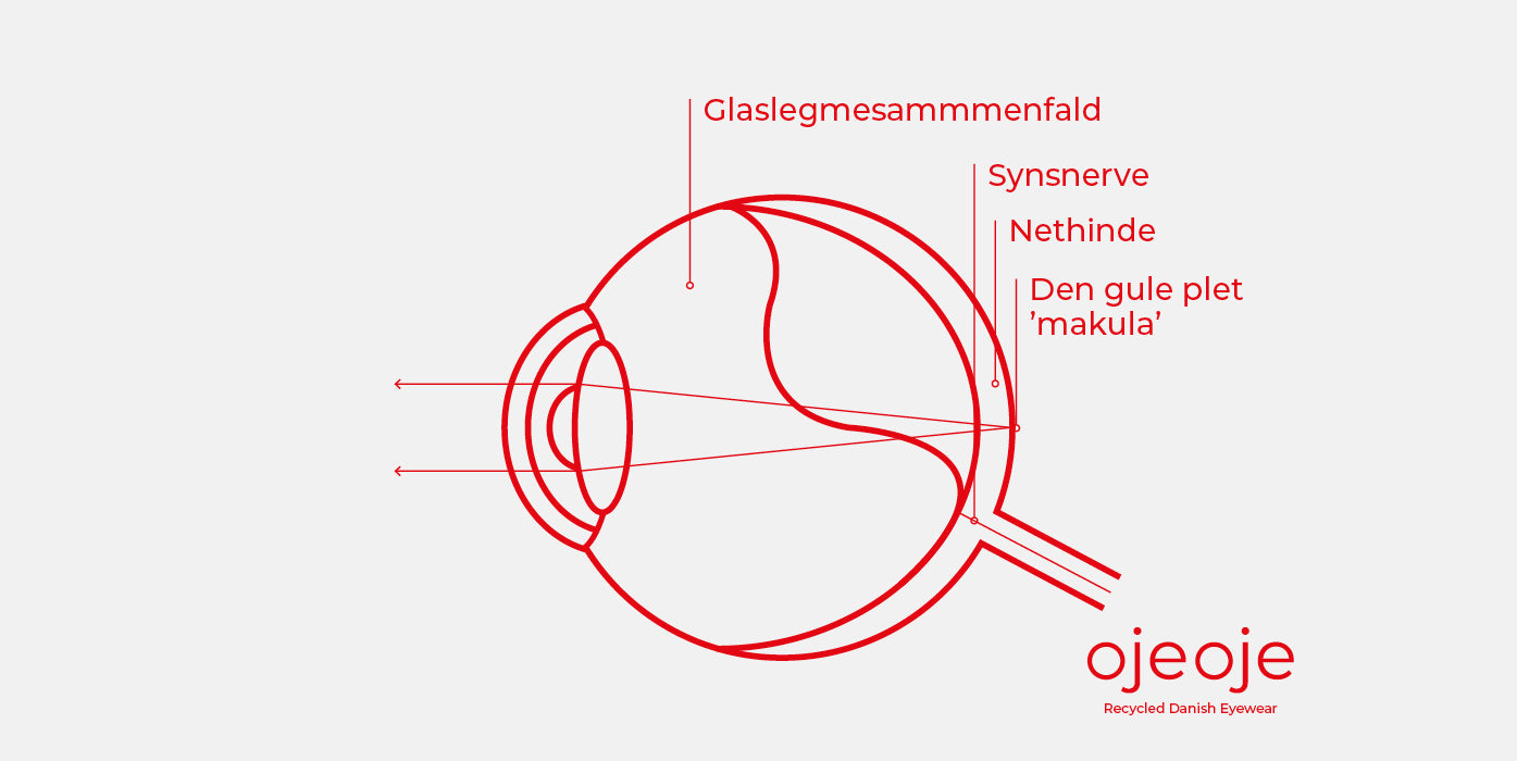 Nethindeløsning (amotio retinae)