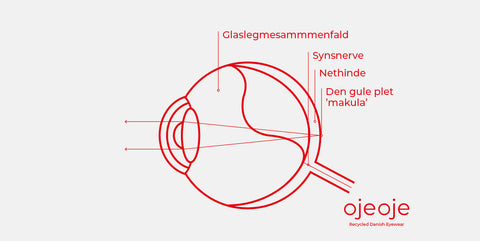Nethindeløsning (amotio retinae)